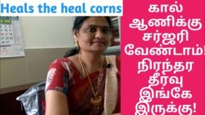 Permanent Treatment to Cure Foot Corn without Surgery/கால் ஆணிக்கு தீர்வு/ in Tamil/Master Mano/V