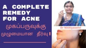 To Permanently Treat Acne | முகப்பருவுக்கு முழுமையான தீர்வு | Master Mano || Tamil | V60
