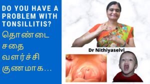 Do you have a Problem with Tonsillitis? Easy Treatment in Homeopathy ! | Tamil | Master Mano | V69