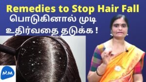 Hair – Care – Dandruff | பொடுகினால் முடி உதிர்வதை தடுக்க ! | Tamil | Master Mano | MM | V105
