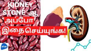 What to eat for kidney stones? | சிறுநீரக கல் கரைய | health tips | tamil | master mano | mm | v122